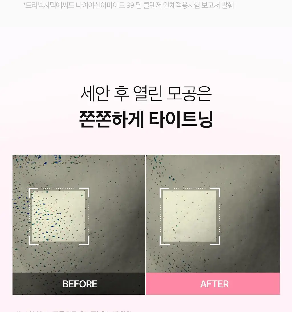 [피지뽑는] 에이프릴스킨 트라넥삼산 딥클렌저 120g 기획 (+15g 미니어처) 상세페이지 39
